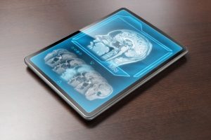 Tablet displaying brain scan on table